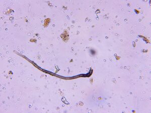 Fungal hypha