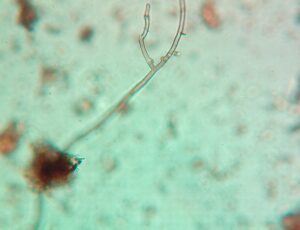 Fungal hypha
