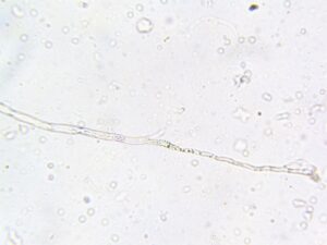 Oomycete